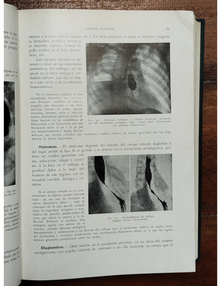 ENFERMEDADES DEL TUBO DIGESTIVO, HÍGADO Y VÍAS BILIARES, PÁNCREAS, PERITONEO Y DIAFRAGMA
